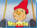 Morbillo
