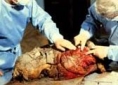 analisi su una mummia