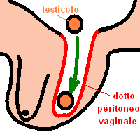 dotto peritoneo-vaginale